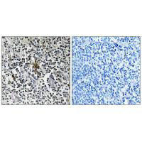 Immunohistochemistry analysis of paraffin-embedded human tonsil tissue using RPS3 antibody.