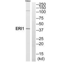 Western blot analysis of extracts from COLO205 cells, using ERI1 antibody. Western blot analysis of extracts from COLO205 cells, using ERI1 antibody.