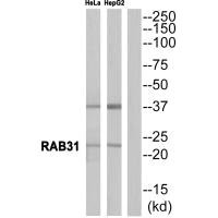 Western blot analysis of extracts from HeLa cells and HepG2 cells, using RAB31 antibody. Western blot analysis of extracts from HeLa cells and HepG2 cells, using RAB31 antibody.
