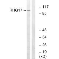 Western blot analysis of extracts from LOVO cells, using RHG17 antibody. Western blot analysis of extracts from LOVO cells, using RHG17 antibody.