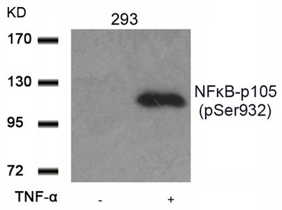 CSB-PA142672