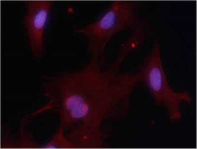 Immunofluorescence staining of methanol-fixed MEF cells using PKM1 Antibody.
