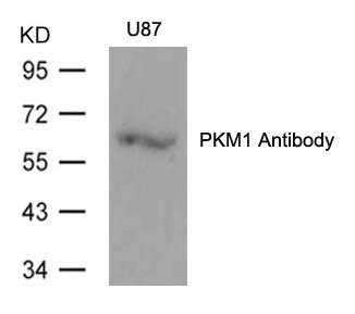 Western blot analysis of extracts from U87 cells using PKM1 Antibody. Western blot analysis of extracts from U87 cells using PKM1 Antibody.