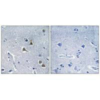 Immunohistochemistry analysis of paraffin-embedded human brain tissue, using ARRDC2 antibody. Immunohistochemistry analysis of paraffin-embedded human brain tissue, using ARRDC2 antibody.