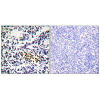Immunohistochemistry analysis of paraffin-embedded human tonsil tissue using NYREN18 antibody. Immunohistochemistry analysis of paraffin-embedded human tonsil tissue using NYREN18 antibody.