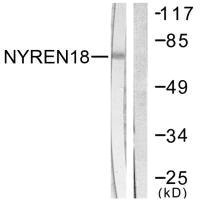Western blot analysis of extracts from COS7 cells, using NYREN18 antibody.
