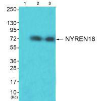 Western blot analysis of extracts from HuvEc cells (Lane 2) and JK cells (Lane 3), using NYREN18 antiobdy. The lane on the left is treated with synthesized peptide.