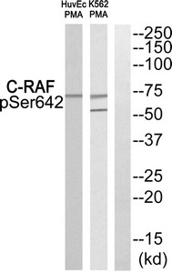 Western blot analysis of extracts from HuvEc cells and K562 cells treated with PMA using C-RAF (Phospho-Ser642) Antibody.The lane on the right is treated with the antigen-specific peptide. Western blot analysis of extracts from HuvEc cells and K562 cells treated with PMA using C-RAF (Phospho-Ser642) Antibody.The lane on the right is treated with the antigen-specific peptide.