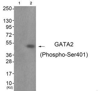 Western blot analysis of extracts from JK cells (Lane 2), using GATA2 (Phospho-Ser401) Antibody. The lane on the left is treated with antigen-specific peptide. Western blot analysis of extracts from JK cells (Lane 2), using GATA2 (Phospho-Ser401) Antibody. The lane on the left is treated with antigen-specific peptide.