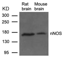 Western blot analysis of extracts from Rat and Mouse brain tissue using nNOS(Ab-852) Antibody. Western blot analysis of extracts from Rat and Mouse brain tissue using nNOS(Ab-852) Antibody.