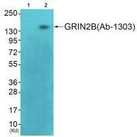 Western blot analysis of extracts from 3T3 cells (Lane 2), using GRIN2B (Ab-1303) antiobdy. The lane on the left is treated with synthesized peptide. Western blot analysis of extracts from 3T3 cells (Lane 2), using GRIN2B (Ab-1303) antiobdy. The lane on the left is treated with synthesized peptide.