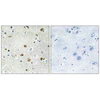 Immunohistochemistry analysis of paraffin-embedded human brain tissue using TF3B antibody.