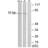 Western blot analysis of extracts from HeLa cells and Jurkat cells, using TF3B antibody. Western blot analysis of extracts from HeLa cells and Jurkat cells, using TF3B antibody.