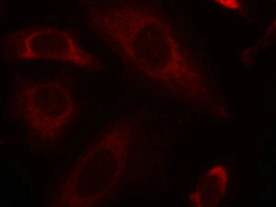 Immunofluorescence staining of methanol-fixed Hela cells using SHP-2(Ab-542) Antibody.