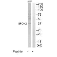 Western blot analysis of extracts from COS7 cells, using SPON2 antibody. Western blot analysis of extracts from COS7 cells, using SPON2 antibody.