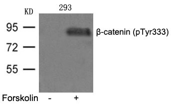Western blot analysis of extracts from 293 cells untreated or treated with FSK using b-catenin(phospho-Tyr333) Antibody. Western blot analysis of extracts from 293 cells untreated or treated with FSK using b-catenin(phospho-Tyr333) Antibody.
