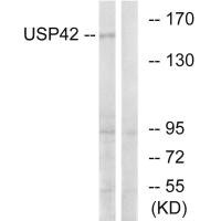 Western blot analysis of extracts from HT-29 cells, using USP42 antibody. Western blot analysis of extracts from HT-29 cells, using USP42 antibody.