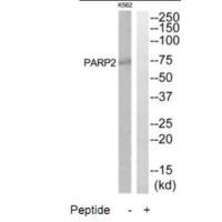 Western blot analysis of extracts from K562 and HuvEc cells, using PARP2 antibody. Western blot analysis of extracts from K562 and HuvEc cells, using PARP2 antibody.
