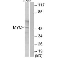 Western blot analysis of extracts from HUVEC cells, using Myc antibody. Western blot analysis of extracts from HUVEC cells, using Myc antibody.