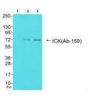 Western blot analysis of extracts from 293 cells (Lane 2) and cos-7 cells (Lane 3), using ICK (Ab-159) antiobdy. The lane on the left is treated with synthesized peptide.