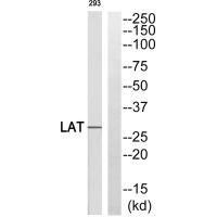 Western blot analysis of extracts from 293 cells, using LAT (Ab-255) antibody. Western blot analysis of extracts from 293 cells, using LAT (Ab-255) antibody.