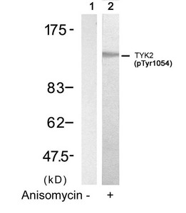 Western blot analysis of extracts from HT29 cells untreated(lane 1) or treated with Anisomycin(lane 2) using TYK2(Phospho-Tyr1054) Antibody. Western blot analysis of extracts from HT29 cells untreated(lane 1) or treated with Anisomycin(lane 2) using TYK2(Phospho-Tyr1054) Antibody.