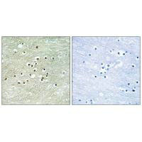 Immunohistochemistry analysis of paraffin-embedded human brain tissue using NPAS4 antibody. Immunohistochemistry analysis of paraffin-embedded human brain tissue using NPAS4 antibody.