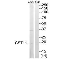 Western blot analysis of extracts from A549 cells, using CST11 antibody. Western blot analysis of extracts from A549 cells, using CST11 antibody.