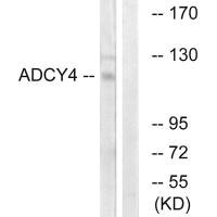 Western blot analysis of extracts from Jurkat cells, using ADCY4 antibody. Western blot analysis of extracts from Jurkat cells, using ADCY4 antibody.