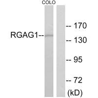 Western blot analysis of extracts from COLO cells, using RGAG1 antibody. Western blot analysis of extracts from COLO cells, using RGAG1 antibody.