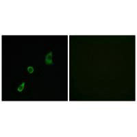 Immunofluorescence analysis of HuvEc cells, using FGF23 antibody.