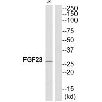 Western blot analysis of extracts from JK cells, using FGF23 antiobdy. Western blot analysis of extracts from JK cells, using FGF23 antiobdy.