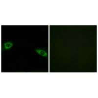 Immunofluorescence analysis of HuvEc cells, using RPS4Y1 antibody.