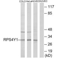 Western blot analysis of extracts from COLO cells, HeLa cells and HUVEC cells, using RPS4Y1 antibody. Western blot analysis of extracts from COLO cells, HeLa cells and HUVEC cells, using RPS4Y1 antibody.