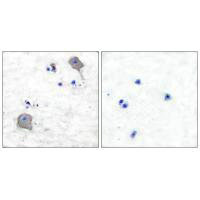 Immunohistochemical analysis of paraffin-embedded human brain tissue using Claudin 5 antibody. Immunohistochemical analysis of paraffin-embedded human brain tissue using Claudin 5 antibody.