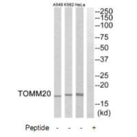 Western blot analysis of extracts from HeLa cells, K562 cells and A549 cells, using TOMM20 antibody. Western blot analysis of extracts from HeLa cells, K562 cells and A549 cells, using TOMM20 antibody.