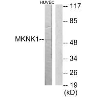 Western blot analysis of extracts from HuvEc cells, using MKNK1 antibody. Western blot analysis of extracts from HuvEc cells, using MKNK1 antibody.