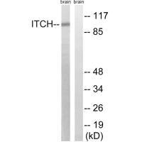 Western blot analysis of extracts from mouse brain cells, using ITCH (Ab-420) antibody. Western blot analysis of extracts from mouse brain cells, using ITCH (Ab-420) antibody.