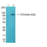 Western blot analysis of extracts from HepG2 cells (Lane 2), using ITCH (Ab-420) antiobdy. The lane on the left is treated with systhesized peptide.