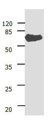Gel: 10%SDS-PAGE Lysate: 30 ug Human liver cancer tissue lysate Primary antibody: 1/400 dilution Secondary antibody: Donkey anti Rabbit IgG - H&L (HRP) at 1/ 3000 dilution Exposure time: 1 minute Gel: 10%SDS-PAGE Lysate: 30 ug Human liver cancer tissue lysate Primary antibody: 1/400 dilution Secondary antibody: Donkey anti Rabbit IgG - H&L (HRP) at 1/ 3000 dilution Exposure time: 1 minute