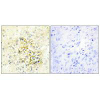 Immunohistochemistry analysis of paraffin-embedded human prostate tissue using TMEPA antibody.