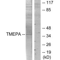 Western blot analysis of extracts from HT-29 cells, using TMEPA antibody. Western blot analysis of extracts from HT-29 cells, using TMEPA antibody.