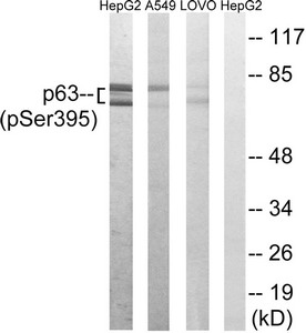 Western blot analysis of extracts from HepG2 cells, A549 cells and LOVO cells all treated with nocodazole (1ug/ml, 18hours), using p63 (Phospho-Ser395) antibody. The lane on the right is treated with the synthesized peptide. Western blot analysis of extracts from HepG2 cells, A549 cells and LOVO cells all treated with nocodazole (1ug/ml, 18hours), using p63 (Phospho-Ser395) antibody. The lane on the right is treated with the synthesized peptide.