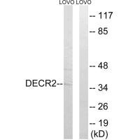 Western blot analysis of extracts from LOVO cells, using DECR2 antibody. Western blot analysis of extracts from LOVO cells, using DECR2 antibody.