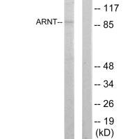 Western blot analysis of extracts from HepG2 cells, using ARNT antibody. Western blot analysis of extracts from HepG2 cells, using ARNT antibody.