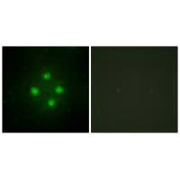 Immunofluorescence analysis of HUVEC cells, using MED24 antibody.