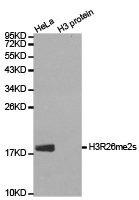 Western blot analysis of extracts of HeLa cell line and H3 protein expressed in E.coli., using H3R26me2s antibody. Western blot analysis of extracts of HeLa cell line and H3 protein expressed in E.coli., using H3R26me2s antibody.