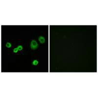 Immunofluorescence analysis of MCF-7 cells, using Cytochrome c-type Heme Lyase antibody.
