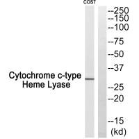 Western blot analysis of extracts from COS7 cells, using Cytochrome c-type Heme Lyase antibody. Western blot analysis of extracts from COS7 cells, using Cytochrome c-type Heme Lyase antibody.