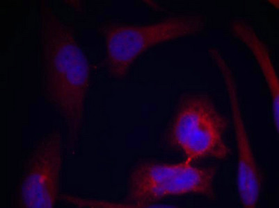 Immunofluorescence staining of methanol-fixed Hela cells using S6 Ribosomal Protein(Phospho-Ser235) Antibody.